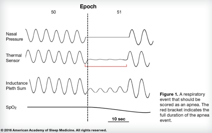 apnea_scoring_criteria.png