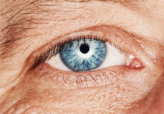 floppy-eye-lid-syndrome-and-sleep-apnea.jpg