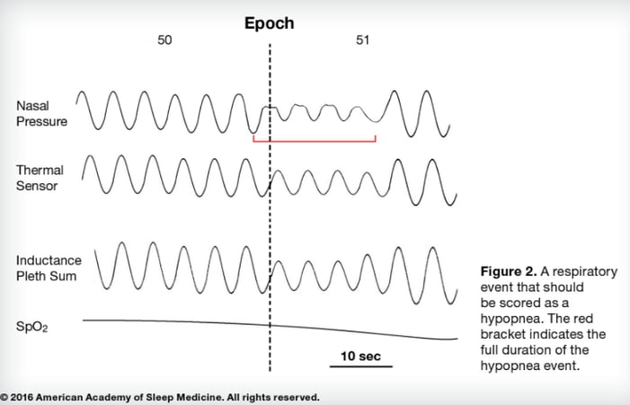 hypopnea_scoring_criteria.png